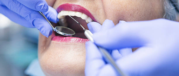 Best Emergency Treatment for Dental Infections or Abscesses in Canadian, TX